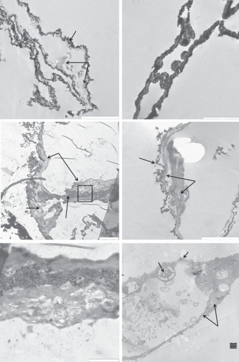 TEM images of (a,c,e) T. rex (MOR 1125) vessels, (b,d ) B. canadensis (MOR 2598) vessels and (f ) ostrich vessels. Tyrannosaurus rex vessels show iron particles infiltrating a relatively amorphous ‘organic’ layer (arrows, a,c). Higher magnification (c) shows a structure similar in morphology to an endothelial cell nucleus seen in ostrich vessel (EN, f ), protruding into the lumen of an isolated vessel. No chromatin or nuclear membrane is visible in the dinosaur structures, but these features are visible in the ostrich. (e) Higher magnification of the area within the box in (c) shows variation in texture within the ‘organic’ layer. B. candensis vessels are more completely infiltrated with iron (b), but in some views (d ), an organic layer is still visible. The ostrich vessel (f ) shows nuclear membrane (EN) within the endothelial cell (EC). Cytoplasmic extensions make up the bulk of the vessel wall, and a TJ uniting two endothelial cells. Scale bar, 2 mm for (a–d), 1 mm for (e,f )